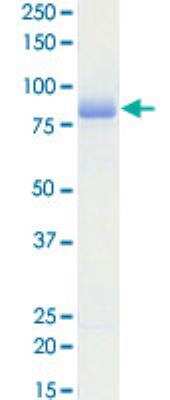 SDS-Page: Recombinant Human Mer Protein [P5596] - 1 ug protein
