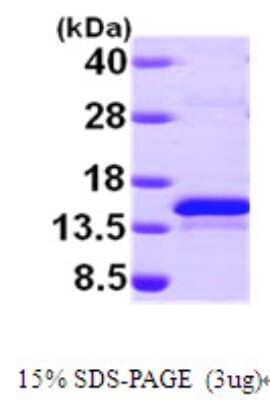 SDS-Page: Recombinant Human Methionine Sulfoxide Reductase B Protein [NBP1-49302] - 15 % SDS-PAGE (3ug)