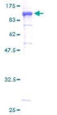 SDS-PAGE Recombinant Human Methylmalonyl Coenzyme A mutase GST (N-Term) Protein