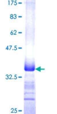 Unknown Recombinant Human MUC5AC GST (N-Term) Protein