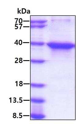 SDS-Page: Recombinant Human Musashi-2 Protein [NBP2-23252] - 3ug by SDS-PAGE under reducing condition and visualized by coomassie blue stain. Molecular Weight:37.6 kDa (351aa), confirmed by MALDI-TOF