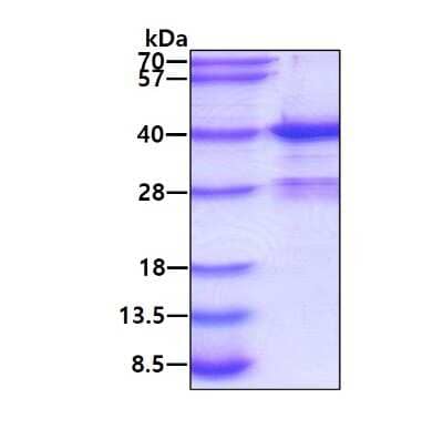 SDS-Page: Recombinant Human Myeloid leukemia factor 1 Protein [NBP1-50985] - 3ug by SDS-PAGE under reducing condition and visualized by coomassie blue stain.