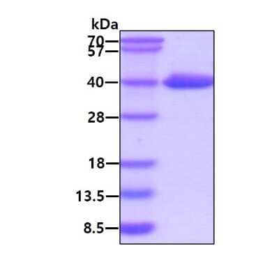 SDS-Page: Recombinant Human N-Acetyl-D-Glucosamine Kinase/NAGK Protein [NBP1-99050] - 3ug by SDS-PAGE under reducing condition and visualized by coomassie blue stain.