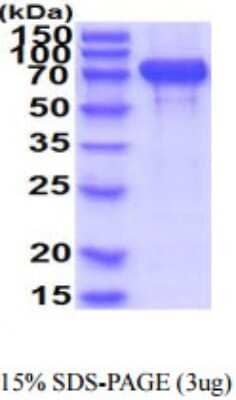 SDS-PAGE Recombinant Human N-Cadherin His Protein