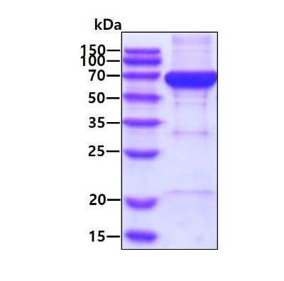 SDS-Page: Recombinant Human NARS His Protein [NBP2-52159] - 3ug by SDS-PAGE under reducing condition and visualized by coomassie blue stain.