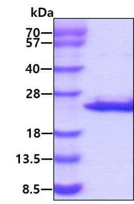 Recombinant Human NAT13 Protein [NBP1-99111] - 3ug by SDS-PAGE under reducing condition and visualized by coomassie blue stain