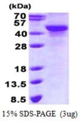 SDS-PAGE Recombinant Human NDRG2 His Protein