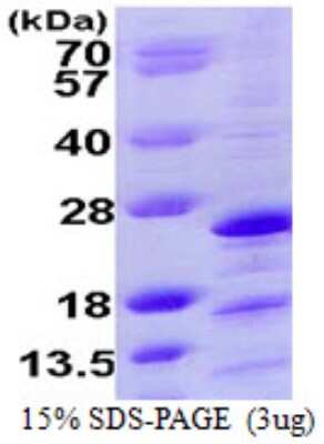 SDS-Page: Recombinant Human NDUFAF2 Protein [NBP1-72379] - 15% SDS-PAGE (3ug)