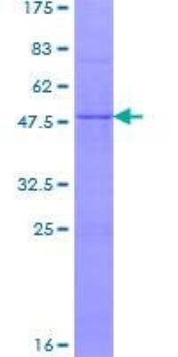 SDS-Page: Recombinant Human NDUFS7 Protein [H00374291-P01] - 12.5% SDS-PAGE Stained with Coomassie Blue.