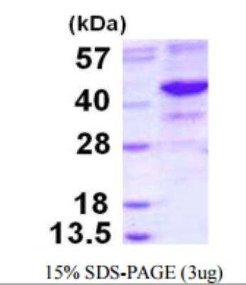 Recombinant Human NEIL2 Protein [NBP1-99001]