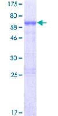 SDS-PAGE Recombinant Human NHLRC2 GST (N-Term) Protein