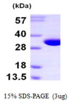 SDS-PAGE Recombinant Human NIT2 His Protein