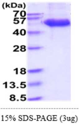 SDS-Page: Recombinant Human NKG2D/CD314 Protein [NBP2-60216] - 15 % SDS-PAGE (3ug)