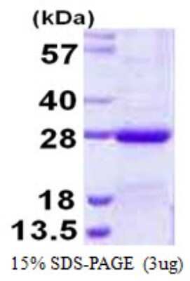 SDS-Page: Recombinant Human NKIRAS2 Protein [NBP1-99008] - 15% SDS-PAGE (3ug)
