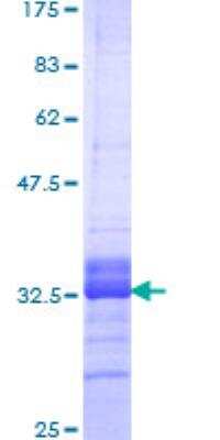 SDS-Page: Recombinant Human NKX3-2 Protein [H00000579-Q01] - 12.5% SDS-PAGE Stained with Coomassie Blue.
