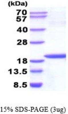 SDS-Page: Recombinant Human NM23-H1 Protein [NBP2-52250] - 15% SDS Page (3 ug)