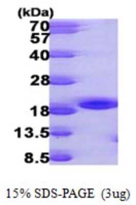 SDS-PAGE Recombinant Human NME3 His Protein