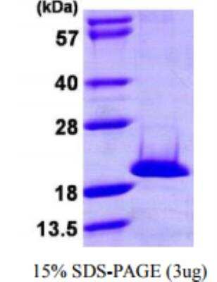 Recombinant Human NME4 Protein [NBP1-72294]