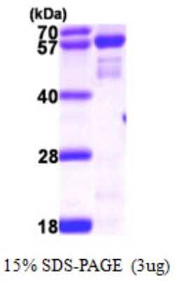 SDS-Page: Recombinant Human NMT2 Protein [NBP1-50989] - 15 % SDS-PAGE (3ug)