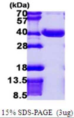 SDS-PAGE Recombinant Human NPL His Protein