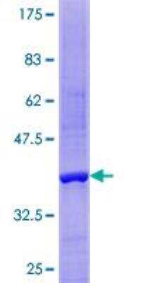 SDS-Page: Recombinant Human NT5C Protein [H00030833-P01] - 12.5% SDS-PAGE Stained with Coomassie Blue.