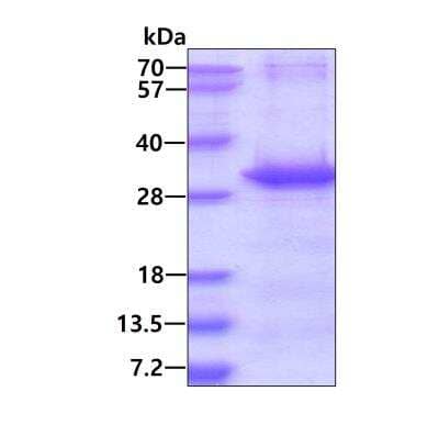 SDS-Page: Recombinant Human NTAL His Protein [NBP1-44385] - 3ug by SDS-PAGE under reducing condition and visualized by coomassie blue stain.