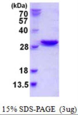 SDS-PAGE Recombinant Human NXT2 His Protein