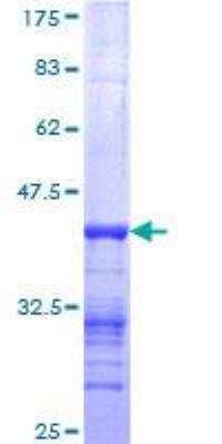 SDS-PAGE Recombinant Human Nebulin GST (N-Term) Protein