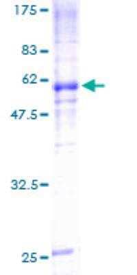 SDS-PAGE Recombinant Human Nicotinic Acetylcholine R alpha 7/CHRNA7 Protein