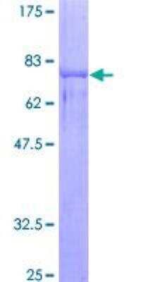 SDS-PAGE Recombinant Human Nova1 GST (N-Term) Protein