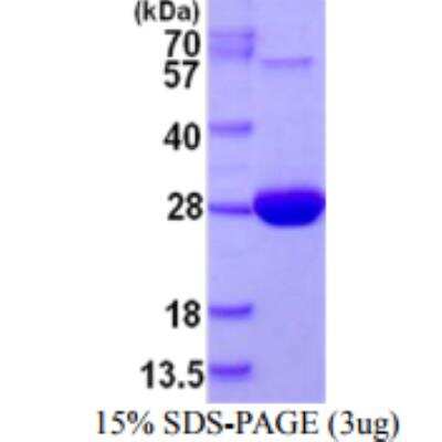Unknown Recombinant Human NRK1 His Protein