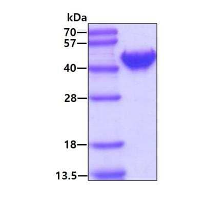 SDS-PAGE Recombinant Human OAS1 His Protein