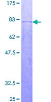 SDS-Page: Recombinant Human OSGIN2 Protein [H00000734-P01] - 12.5% SDS-PAGE Stained with Coomassie Blue.