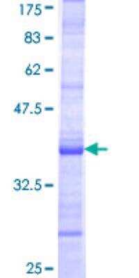 SDS-Page: Recombinant Human OSGIN2 Protein [H00000734-Q01] - 12.5% SDS-PAGE Stained with Coomassie Blue.