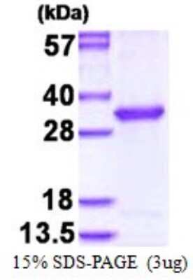 SDS-PAGE Recombinant Human OVCA2 His Protein