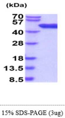 SDS-Page: Recombinant Mouse ADK Protein [NBP2-61193] - 15 % SDS-PAGE (3ug)