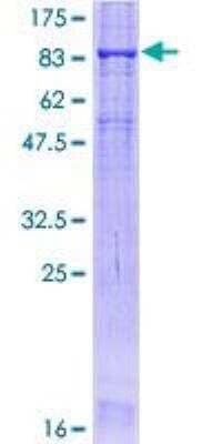 SDS-Page: Recombinant Human Occludin Protein [H00004950-P01] - 12.5% SDS-PAGE Stained with Coomassie Blue.