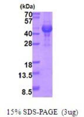 SDS-Page: Recombinant Human Opticin Protein [NBP2-51922] - 15% SDS Page (3 ug)