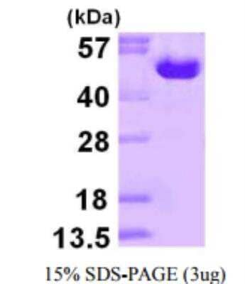 Recombinant Human Ornithine Decarboxylase Protein [NBP1-72494]