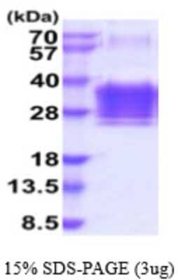 SDS-Page: Recombinant Human Orosomucoid 2 Protein [NBP2-59560] - 15% SDS-PAGE (3ug)