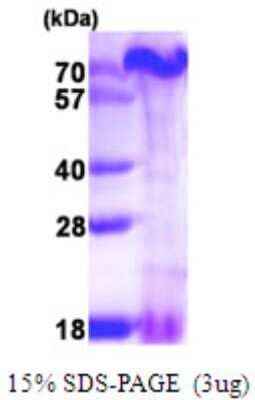 SDS-Page: Recombinant Human PA1 Protein [NBP1-72305] - 15% SDS-PAGE (3ug)