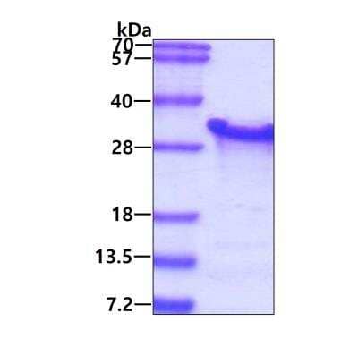 SDS-PAGE Recombinant Human PAIP2 His Protein