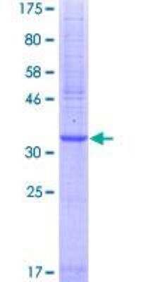 SDS-PAGE Recombinant Human PAR2 GST (N-Term) Protein