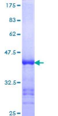 SDS-Page: Recombinant Human PARP4 Protein [H00000143-Q01] - 12.5% SDS-PAGE Stained with Coomassie Blue.