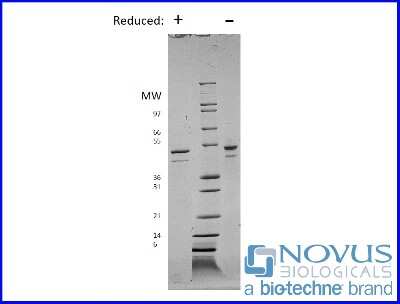 SDS-Page: Recombinant Human PBEF/Visfatin/NAMPT Protein [NBP2-76226] - 1 ug in each lane (-) non-reducing conditions and (+) reducing conditions in a 4-20% Tris-Glycine gel.