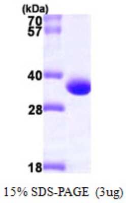 SDS-Page: Recombinant Human PBLD Protein [NBP1-50876] - 15 % SDS-PAGE (3ug)