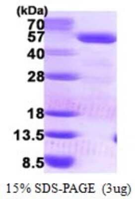 SDS-Page: Recombinant Human PCYT2 Protein [NBP1-78847] - 15% SDS-PAGE (3ug)