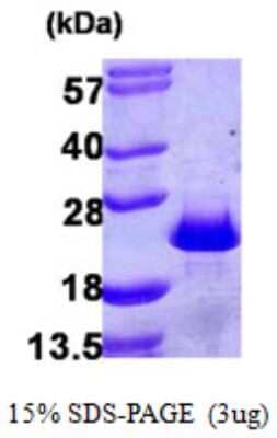 SDS-PAGE Recombinant Human PDCD6 His Protein