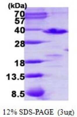 SDS-PAGE Recombinant Human PDCL3 His Protein