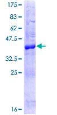 SDS-PAGE Recombinant Human PERP GST (N-Term) Protein